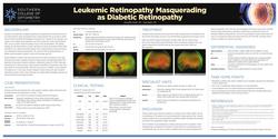 Leukemic Retinopathy Masquerading as Diabetic Retinopathy